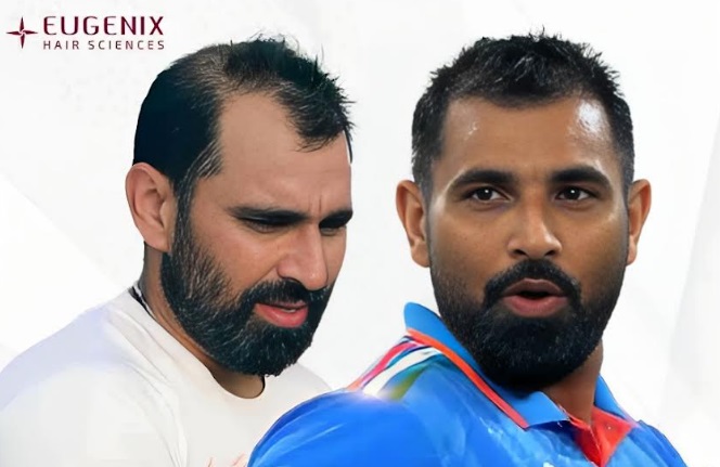 Mohammed Shami: A Stunning Transformation On and Off the Pitch