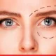 Revitalize Your Look: Non-Surgical Approach to Treat Droopy Eyes 