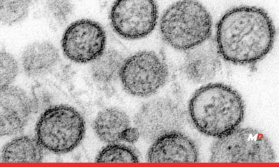 Should you worry about Hantavirus?